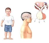 Bebeklerde Büyüme Hormonu Kullanımı ve Faydaları Nelerdir?