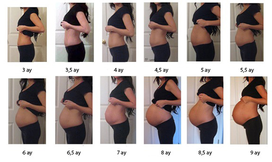 Gebelikte Rahim Büyümesi Belirtileri ve Tedavisi